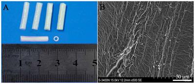 The Effects of Epidermal Neural Crest Stem Cells on Local Inflammation Microenvironment in the Defected Sciatic Nerve of Rats